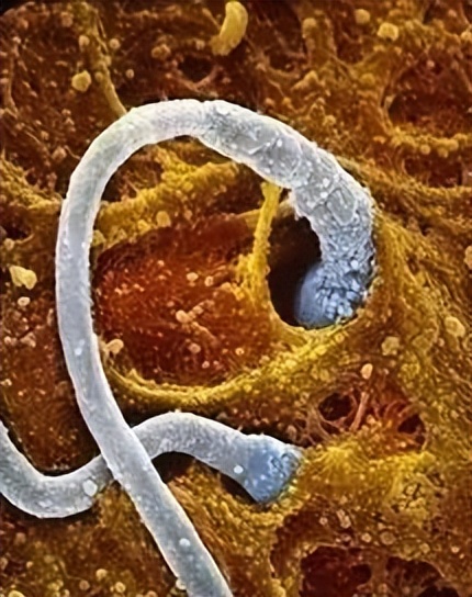 男性才是感染hpv病毒的主力军,hpv病毒到底是男人有还是女人有