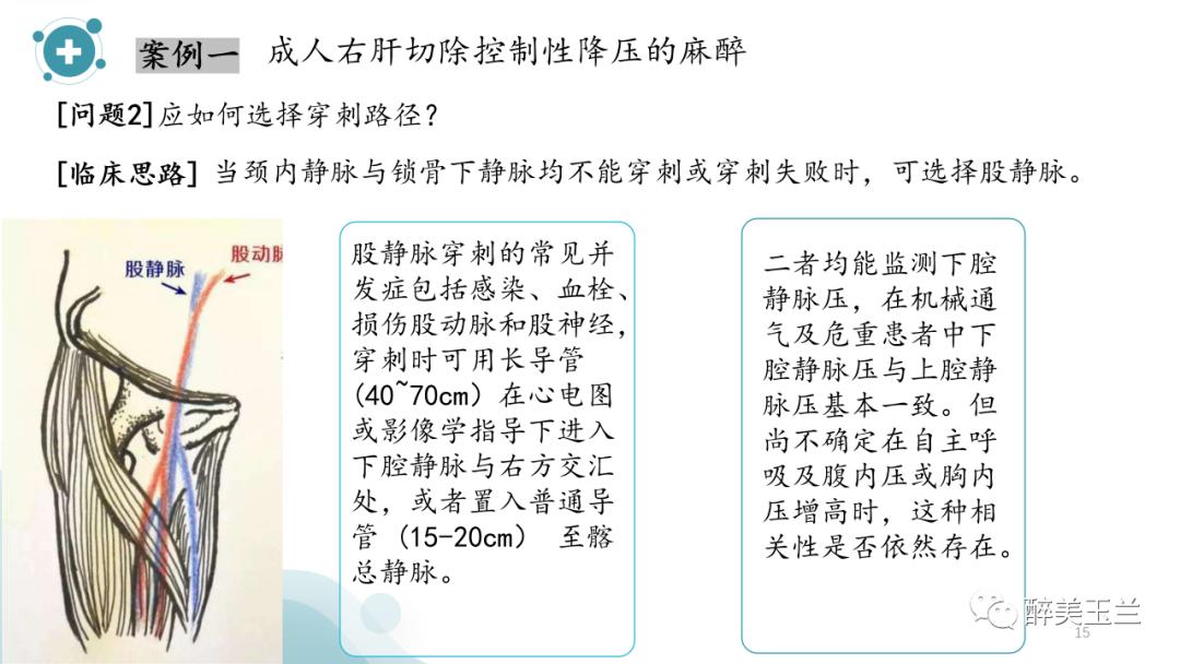 深静脉穿刺置管术讲解ppt,中心静脉穿刺置管深度