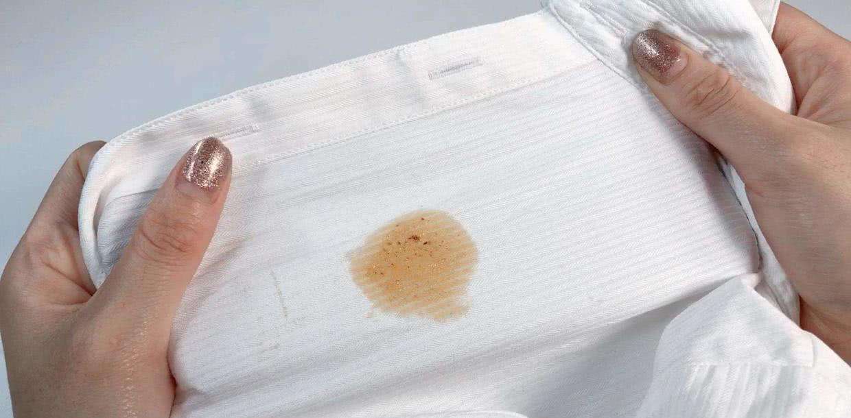 白衣服污垢洗不掉怎么能去除,衣服上面溅了油怎么洗掉