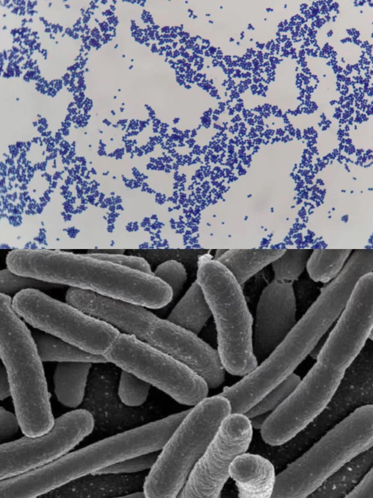 盆腔炎杀手,女性妇科疾病隐形杀手