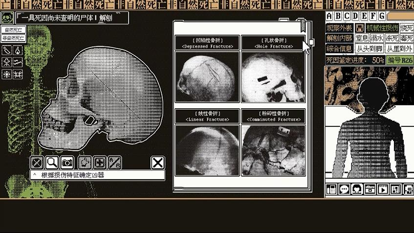 非自然死亡七大死因,自然死亡的具体死因