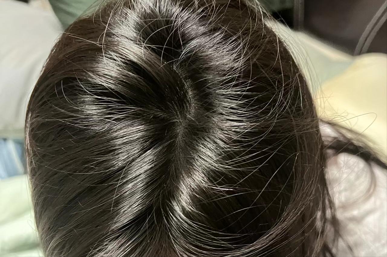 怎么克服脱发最有效,摆脱脱发困扰的小妙招