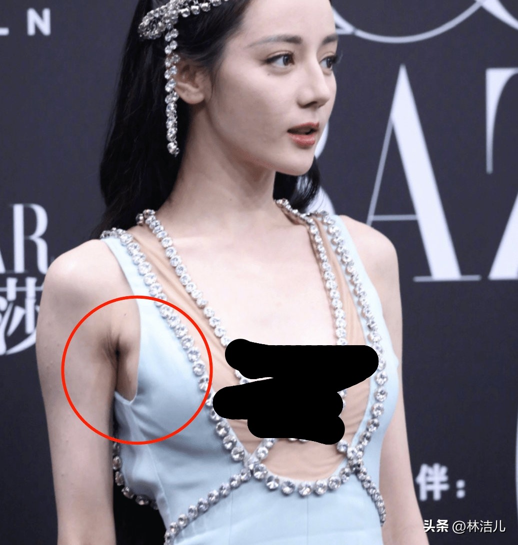 女明星腋下怎么护理,明星如何腋下美白