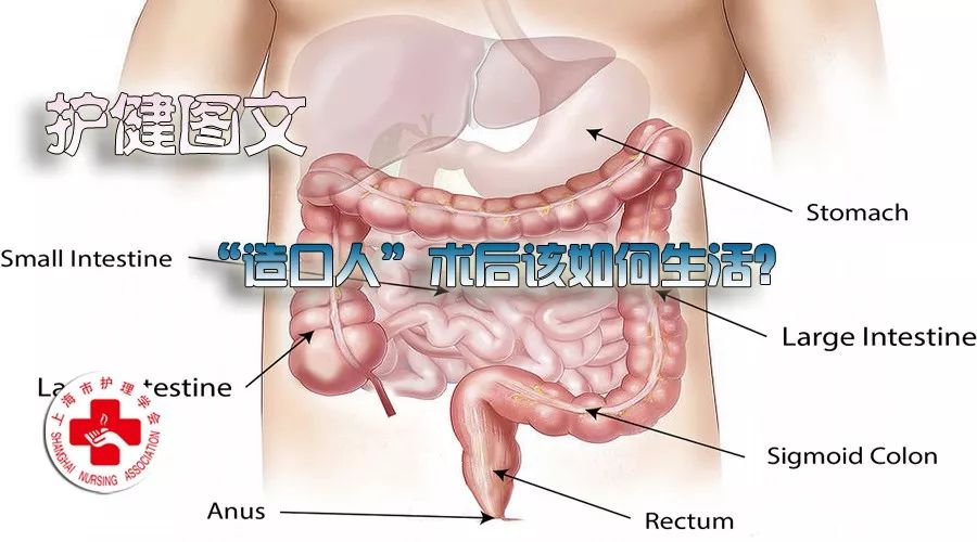 造口人术后怎么护理,造口患者日常生活护理宣教
