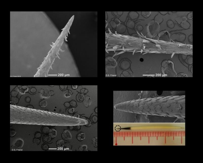 蟒蛇吞野猪被刺死,豪猪刺死巨蟒蛇