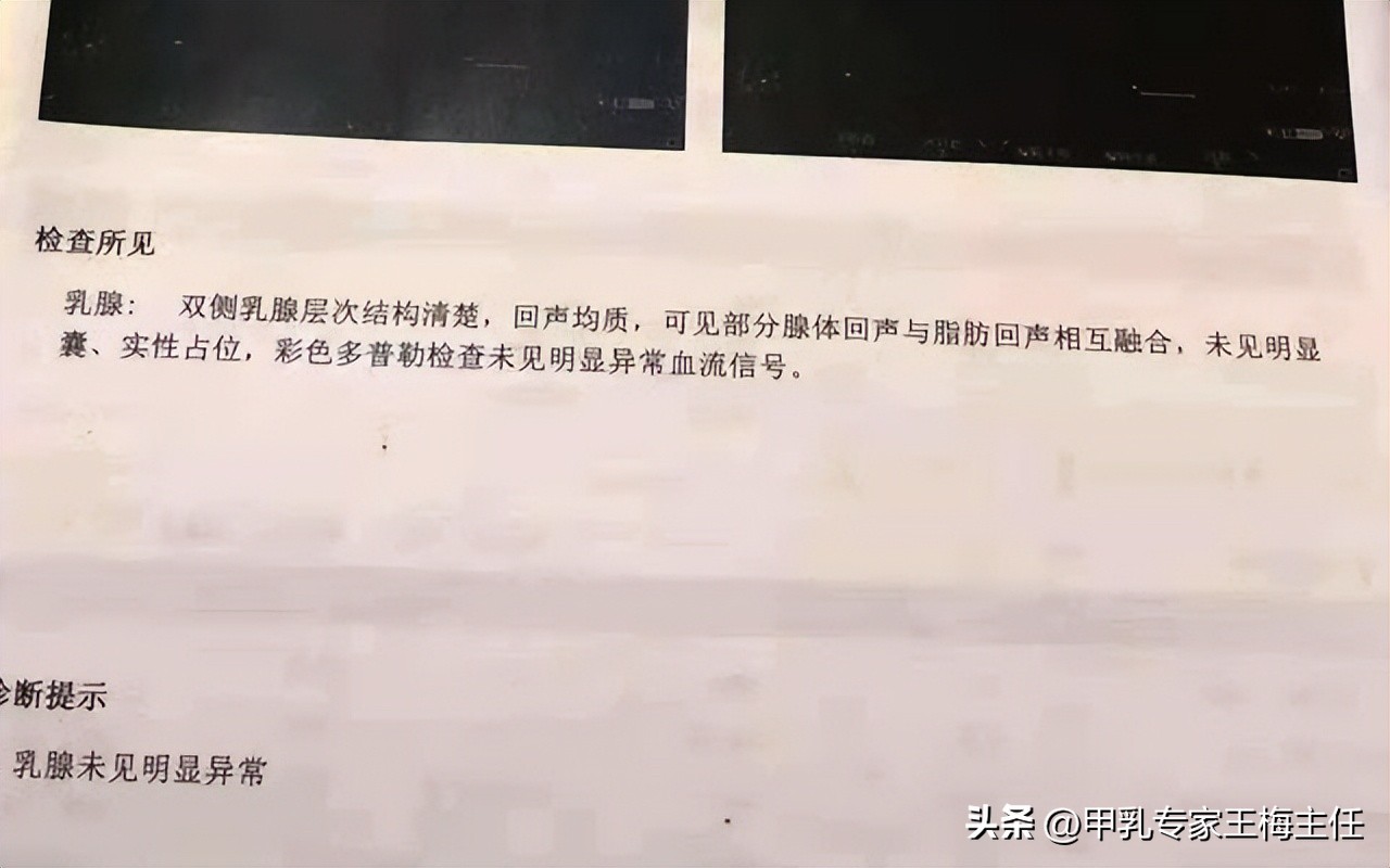 张仲景治疗乳腺结节经方,治乳腺结节的中药一天喝几次