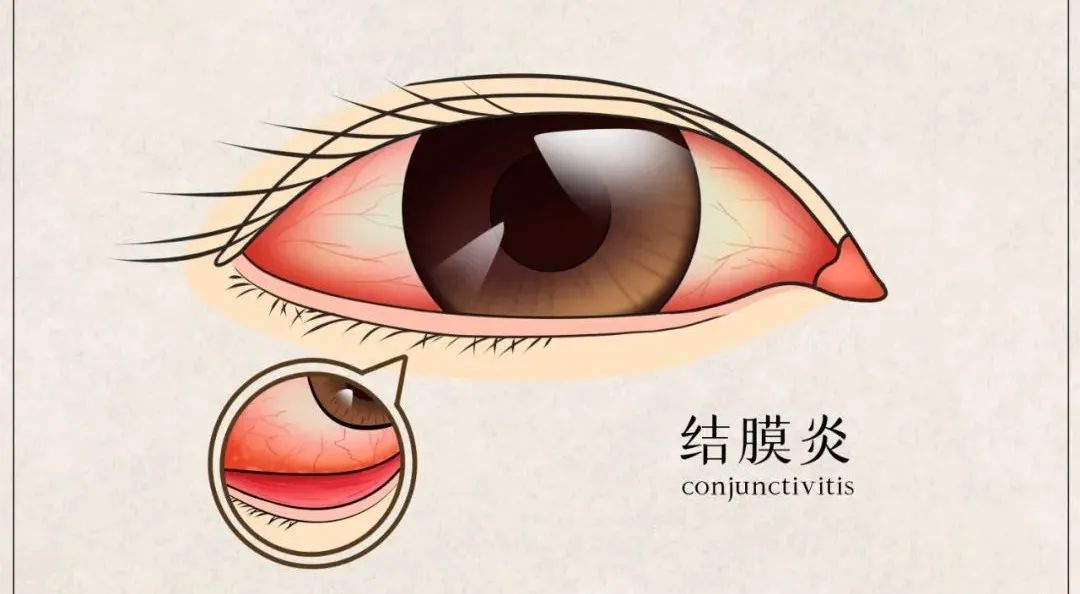 狼疮起皮疹了什么原因,狼疮患者平时皮肤会很差吗