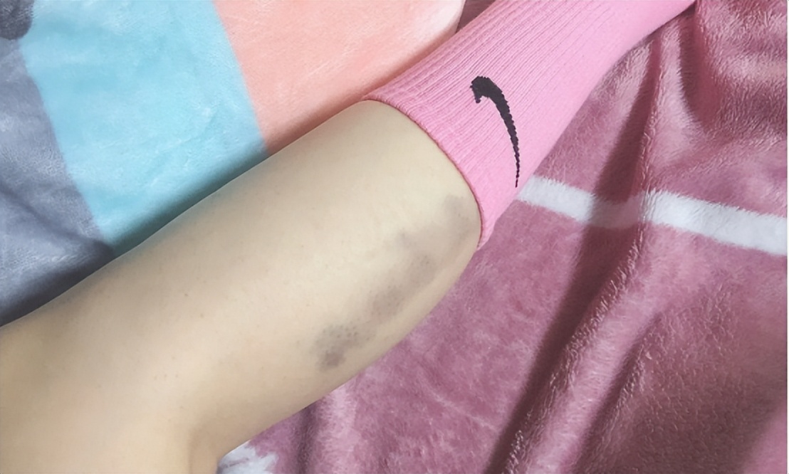 测评口碑最好的筋膜枪,测评筋膜枪热门