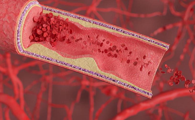 一天接了3个急诊，都是黄体破裂，黄体到底是什么？看完涨知识了