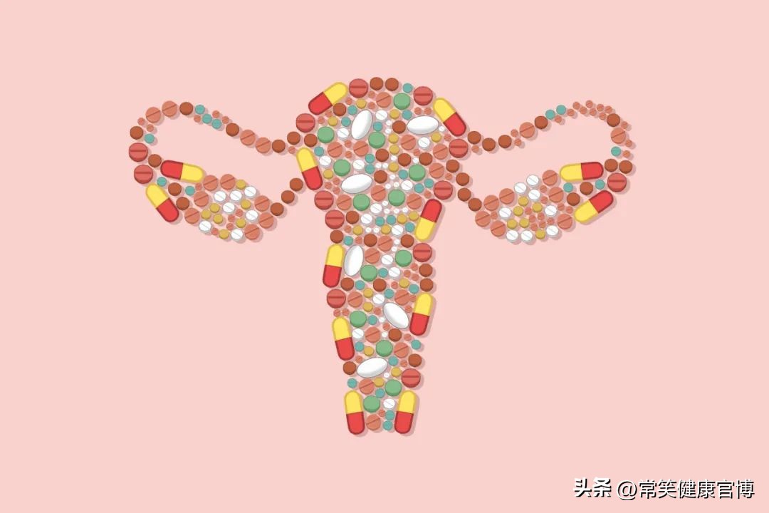 很多女人的困惑:为啥莫名“中招”滴虫阴道炎?