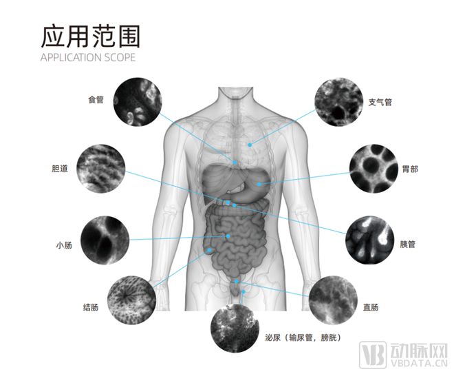 连拿3张医疗器械注册证,精微视达何以领跑国产共聚焦显微内窥镜？