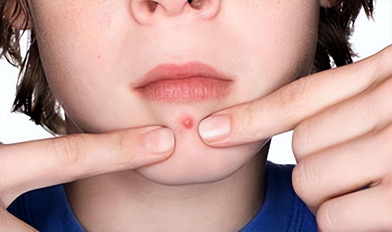 上热下寒一味药就好的视频,上热下寒打通中焦的穴位