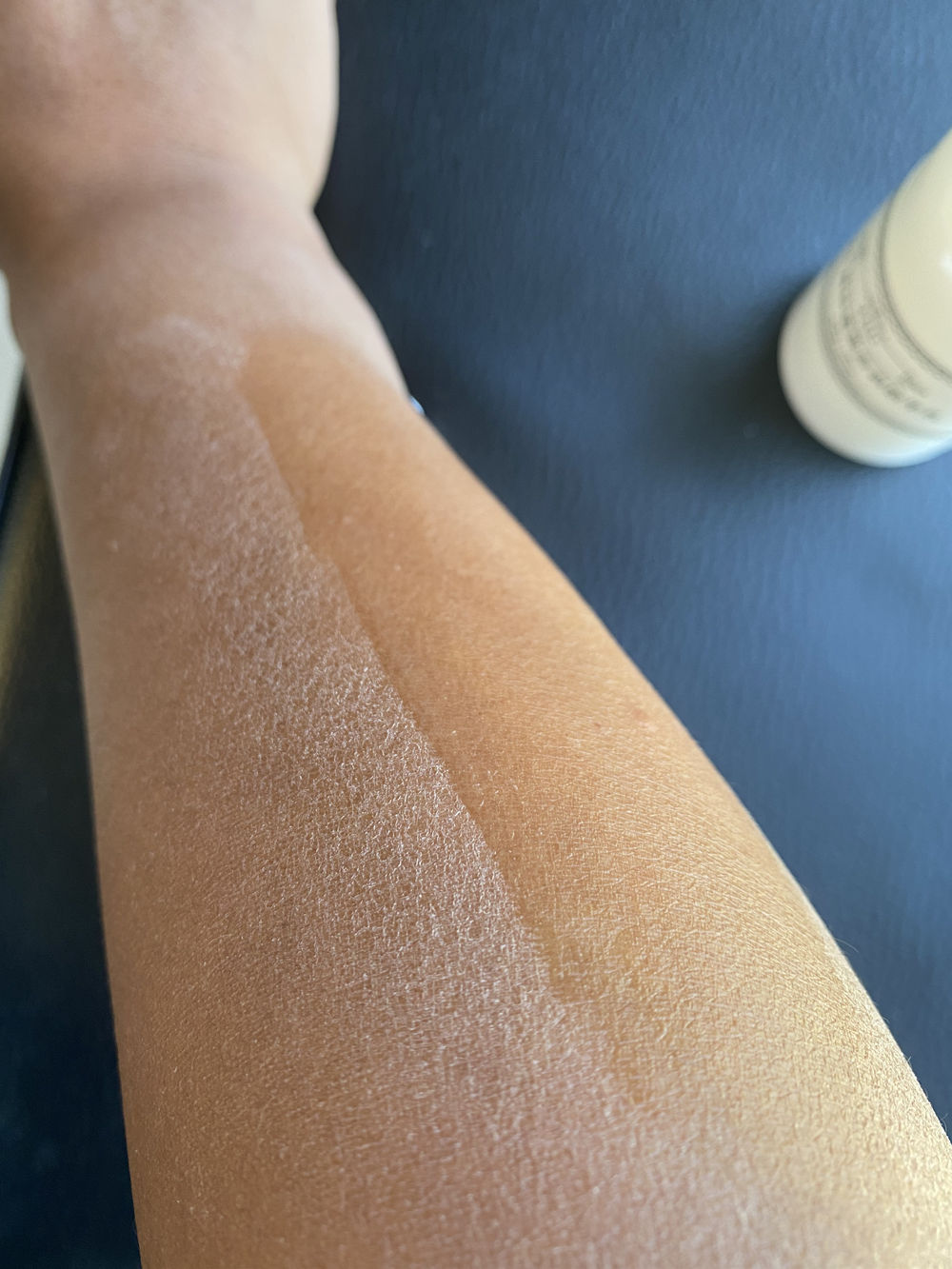 每到秋天，手和腿上就会出现各种干燥情况，还会脱皮，要怎么办？