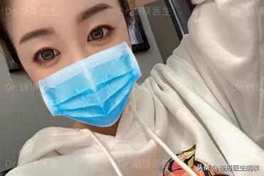 双眼皮术后20天基本不再变化了,挑战双眼皮术后39天做睫毛