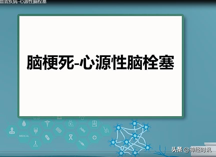 神经病学-脑血管疾病-心源性脑栓塞课件分享加视频讲解