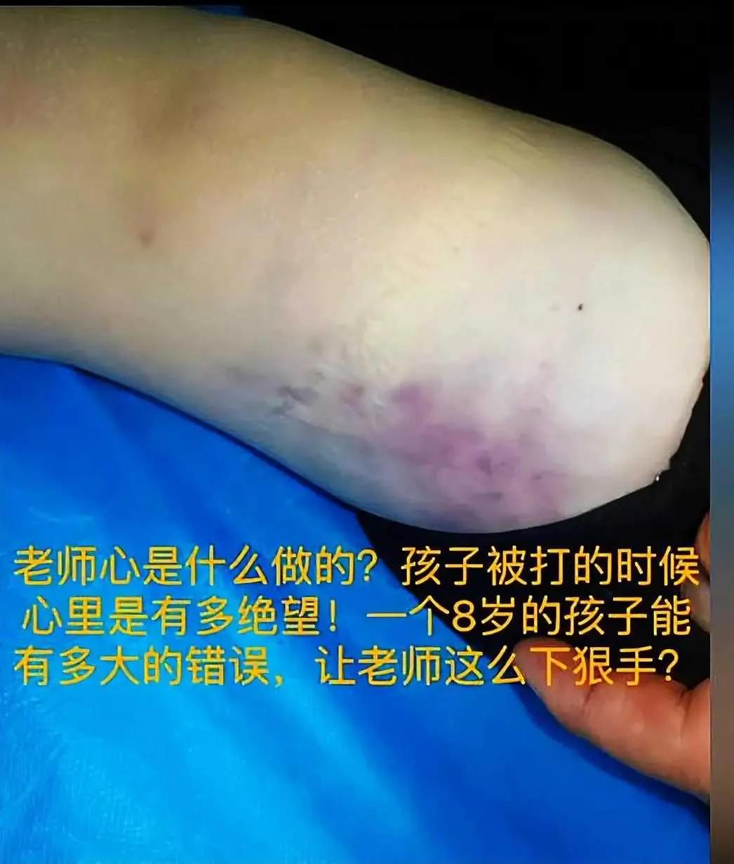 青岛武术馆事件真相,青岛聚英武术俱乐部打人怎么判刑