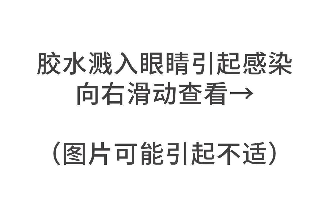 眼睛被热水溅到怎么处理,502不慎溅入眼睛要冲洗多久