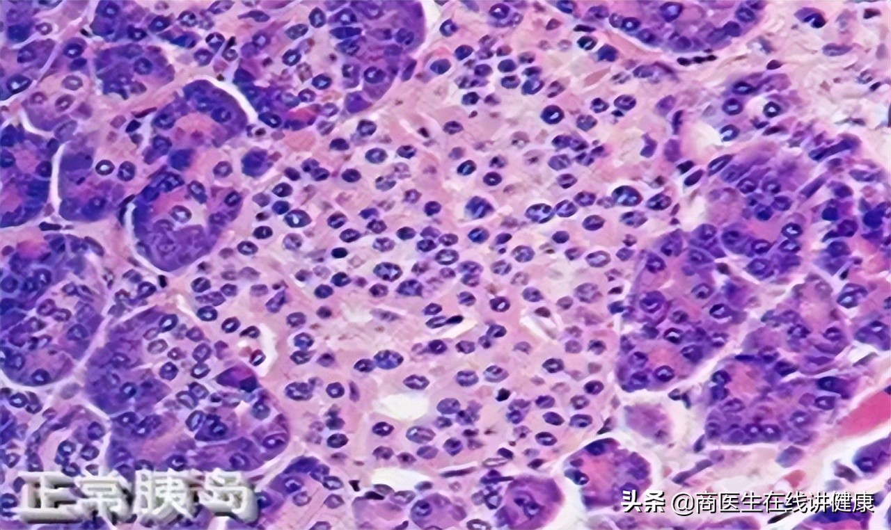 吃花生对胰岛功能的影响,常吃花生对心血管有害吗