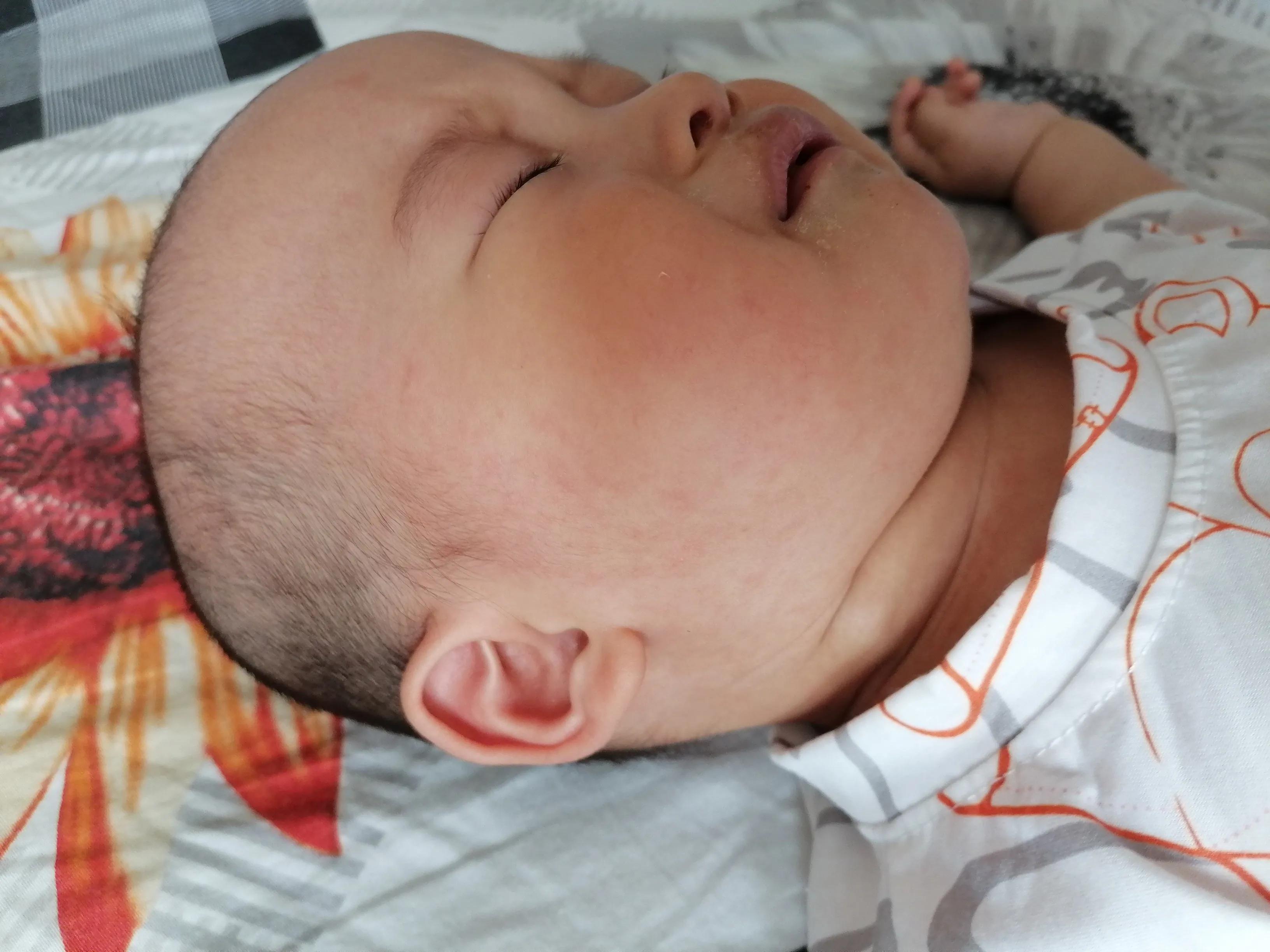 宝宝急疹一般几天痊愈,9个月宝宝幼儿急疹高热怎么喂药