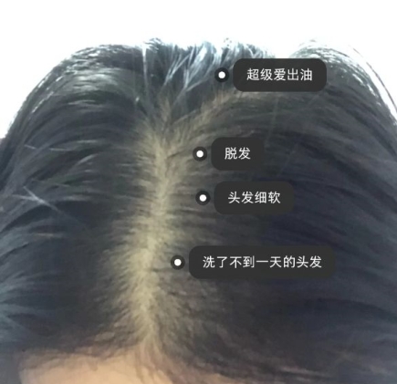 什么洗发水控油不脱发,适合妈妈用的防脱发洗发水
