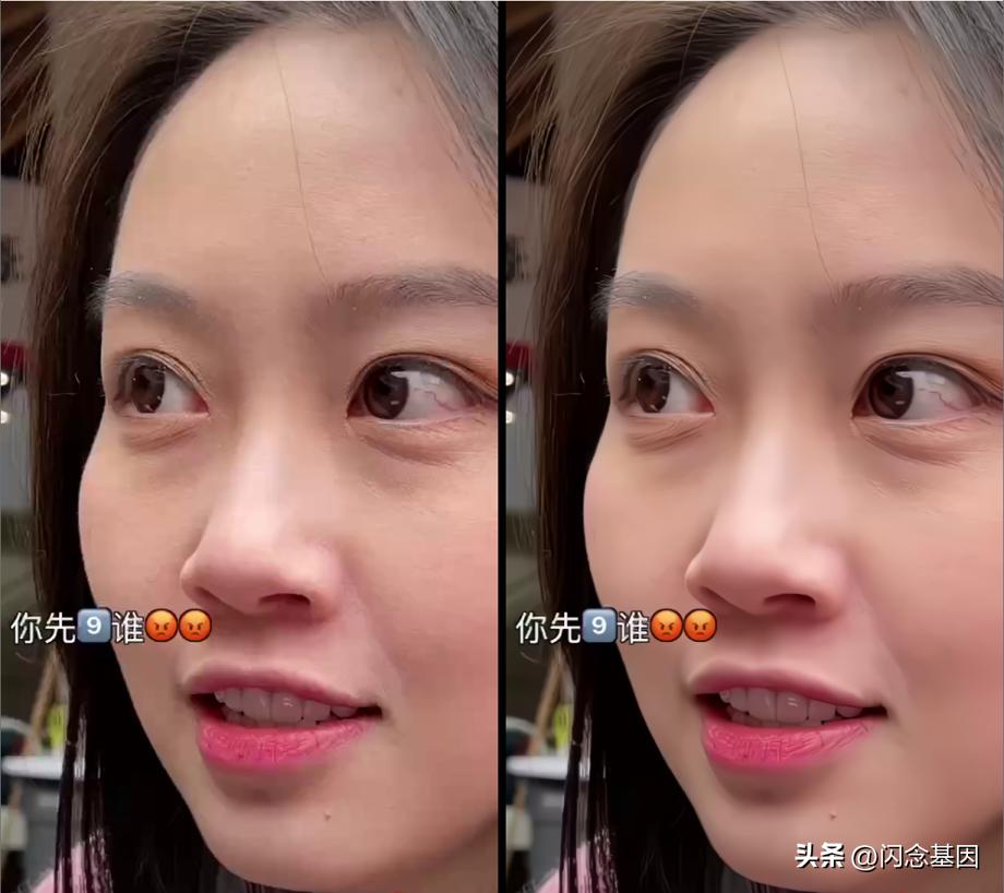 窄带高清,窄带高清技术讲解