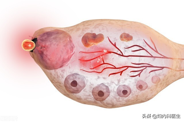 月经来一两天就干净是怎么回事,月经总是一月来两回是什么毛病
