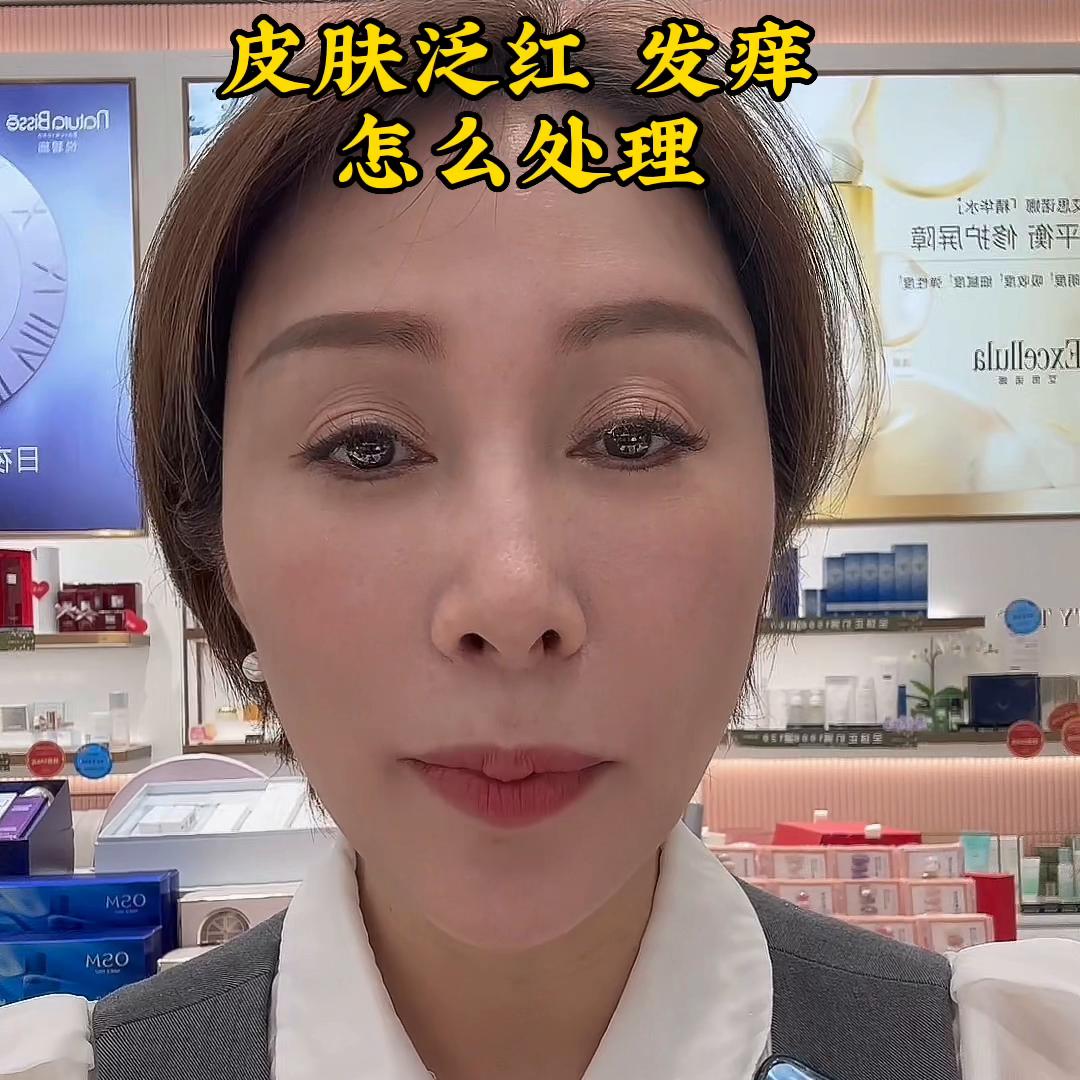 皮肤泛红发痒怎么办,儿童春季皮肤过敏泛红发痒小妙招
