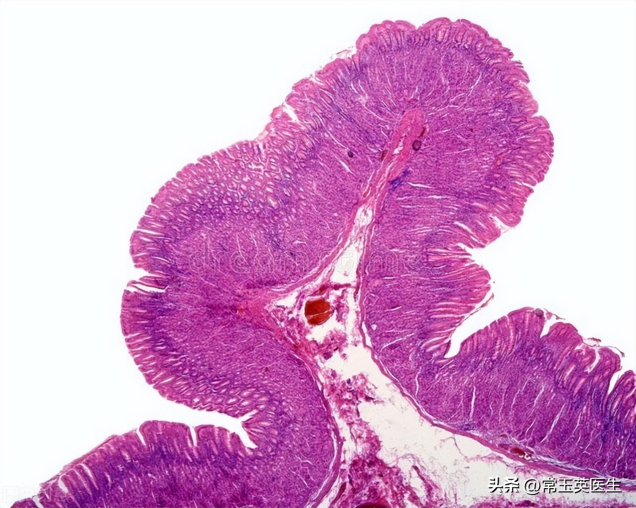 胃黏膜保护的中成药 (胃黏膜保护剂怎么卖)