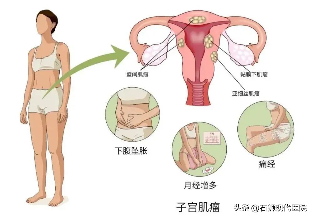 48岁的女人妇科体检应该做哪几项,妇科检查怎么查