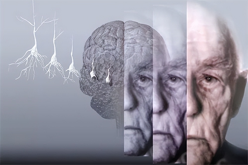 nsksd纳豆激酶中期成果,nsk-sd纳豆激酶怎么样