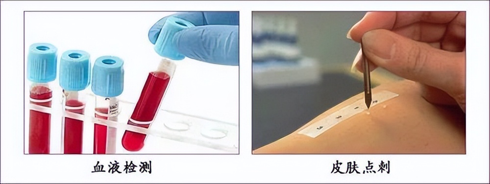 专病特治|门头沟区医院开设过敏（变态反应）专病门诊