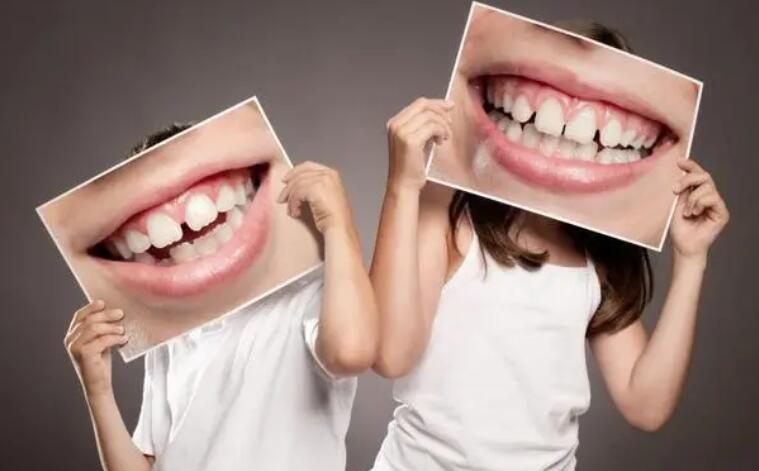 牙齿中线不齐导致嘴歪可以矫正么,宝宝牙齿长歪了怎么矫正