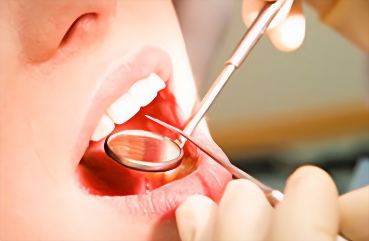 牙周炎跟血液有关系吗,牙周疾病与心脑血管疾病的关系