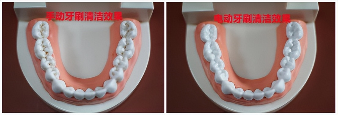 哪个牌子的电动牙刷好用不伤牙,儿童电动牙刷不伤牙齿刷的干净