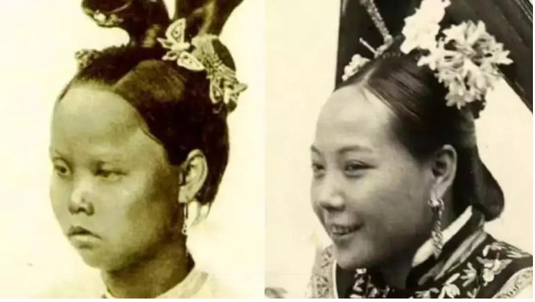 扁头有多毁颜值,扁头对颜值影响有多大