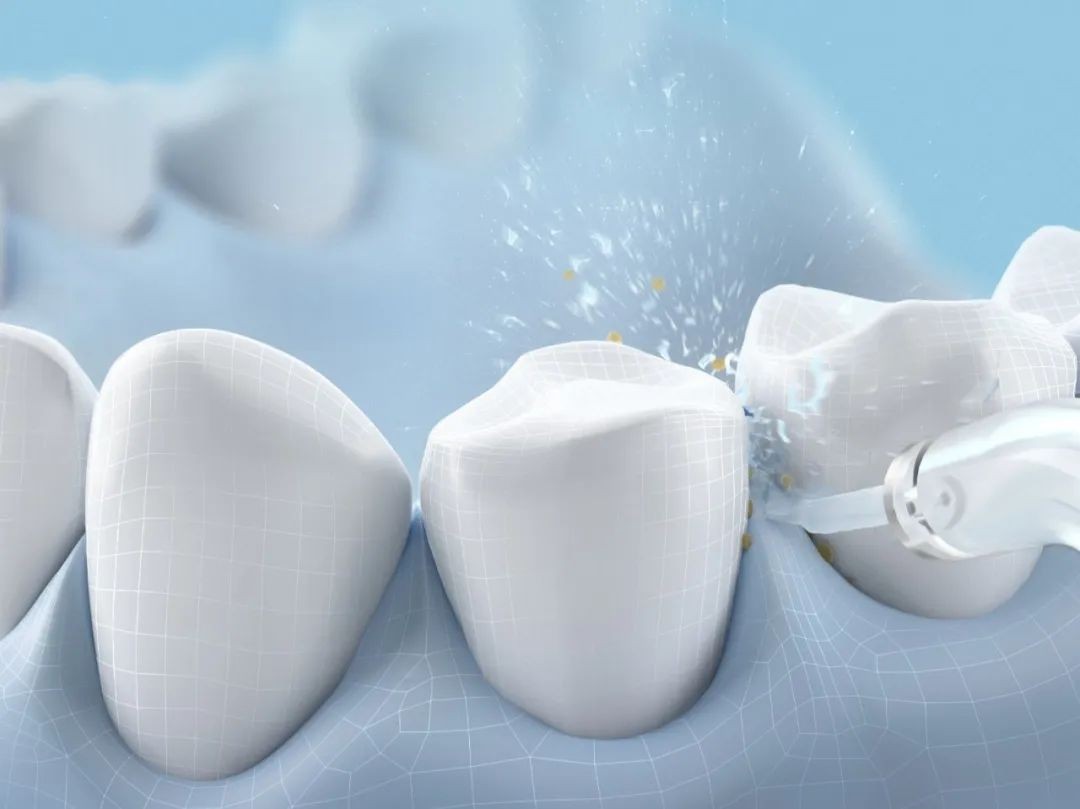 用牙线剔牙有什么坏处吗,冲牙器的危害医生回答