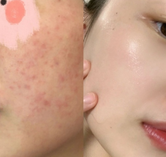 cemoy水乳孕妇可以用吗,后粉色水妍水乳孕妇可以用吗