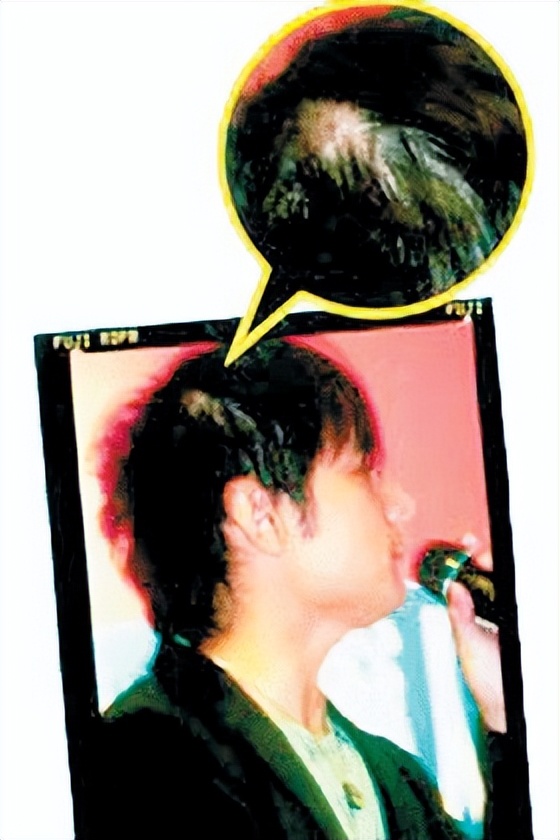 周杰伦黄晓明沙溢吴彦祖聂远,黄晓明周杰伦头发稀疏