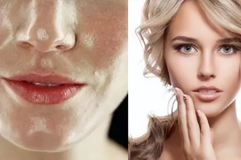 t区容易出油怎么护肤,脸上爱出油护肤