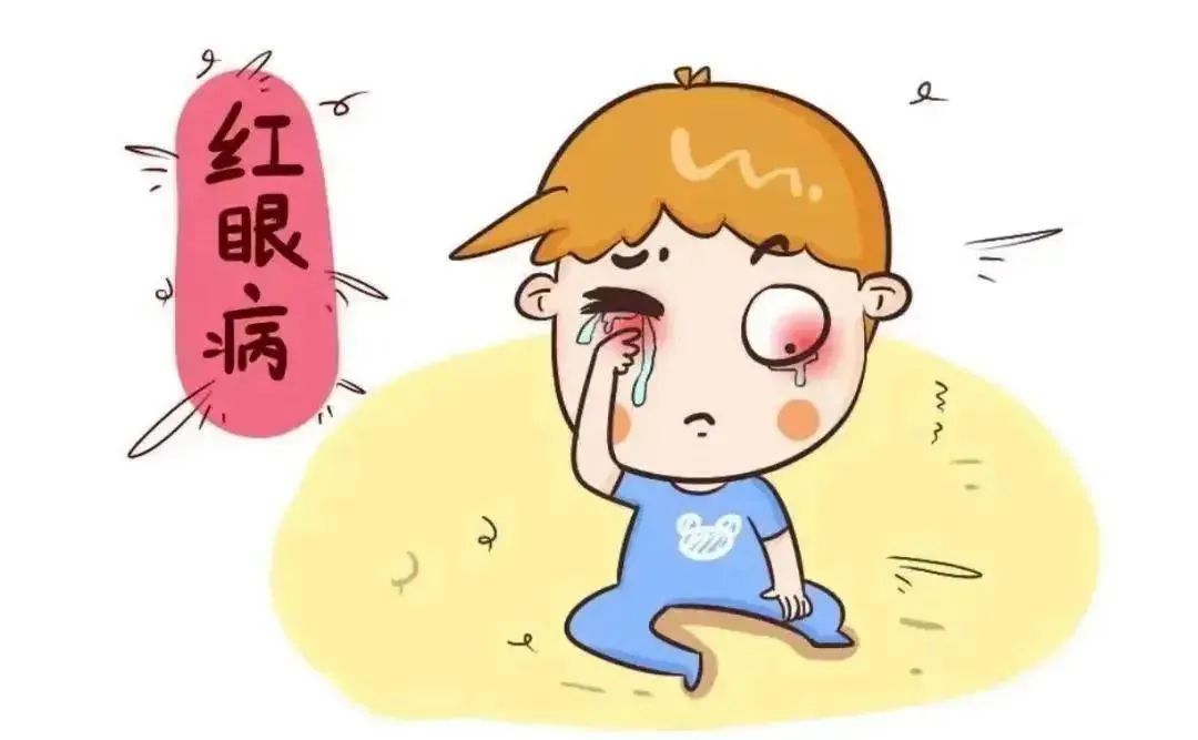 红眼病的预防措施视频,红眼病急性出血性结膜炎