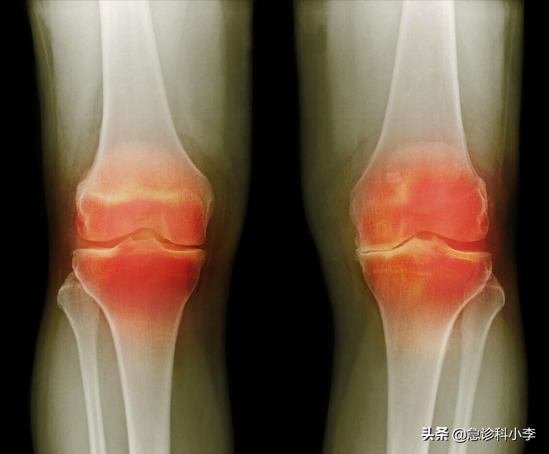 5种常见的疾病目前无法根治，千万别被忽悠了