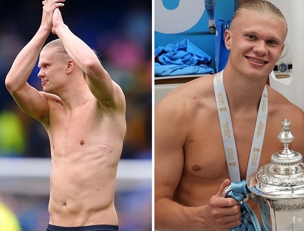 哈兰德身材对比姆巴佩,哈兰德的腿部肌肉