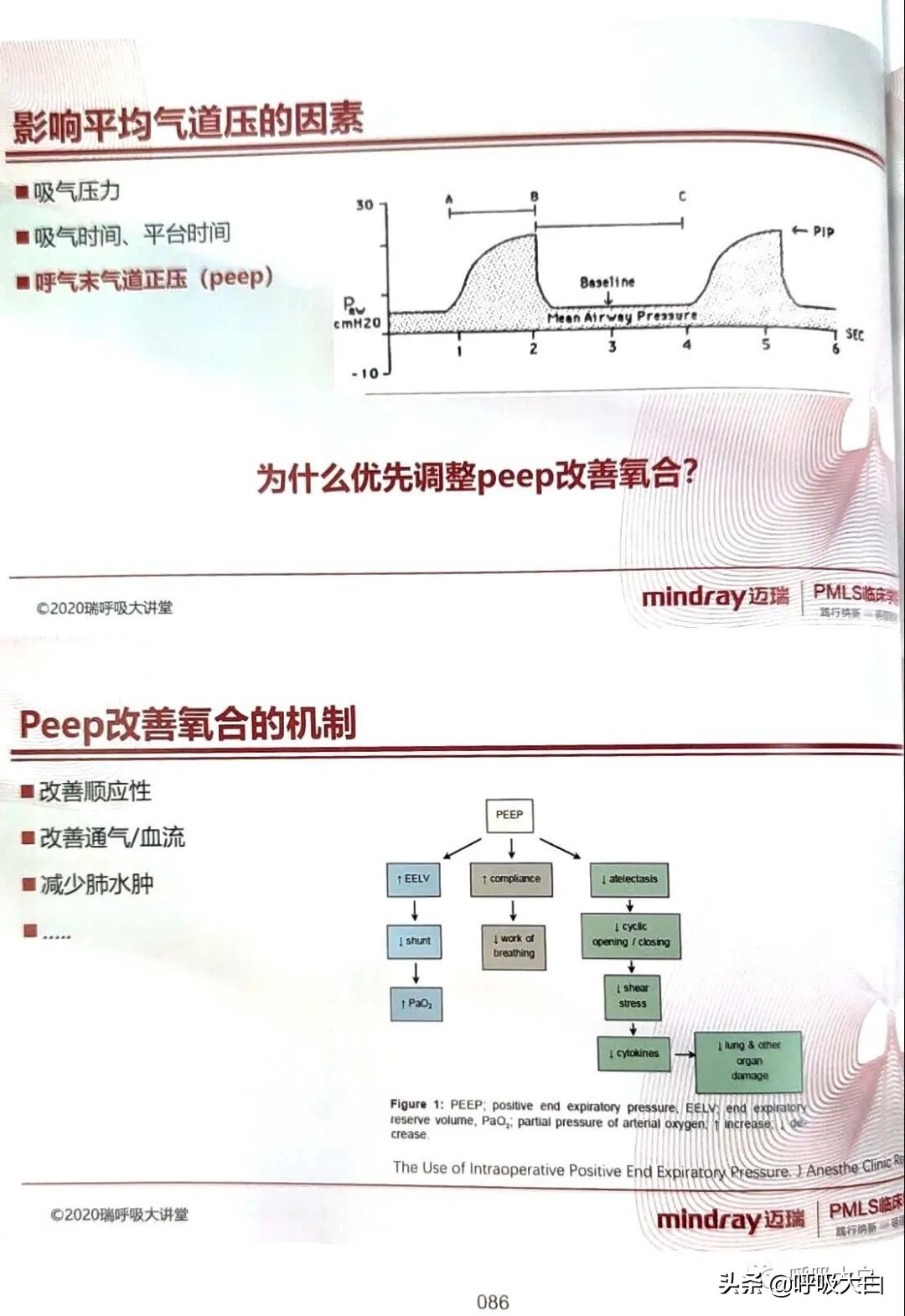 呼吸机epr怎么调节,呼吸机如何调节温度
