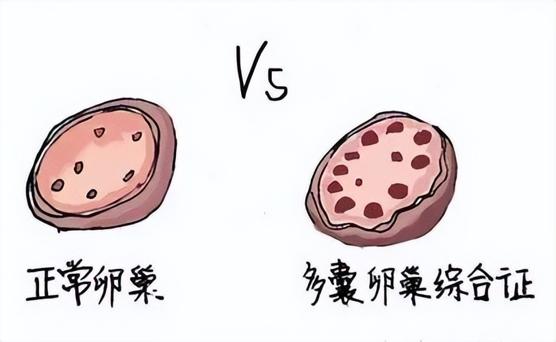 孩子经期初潮两年后月经不规律一定要注意
