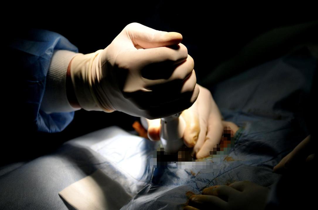 包皮过长容易导致妇科病怎么清洗,包皮过长会不会引起妇科病