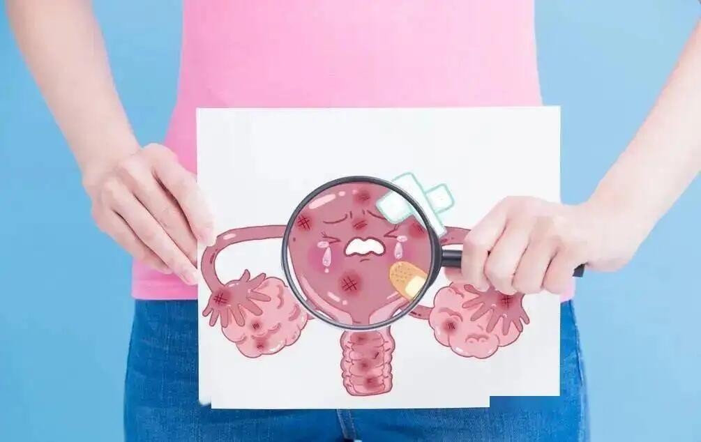 紧急提醒：有人中招查出宫颈癌？身上有一股臭味，不能大意