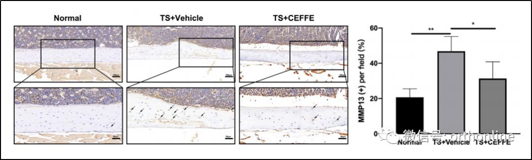 无细胞脂肪活性蛋白预防骨质疏松研究