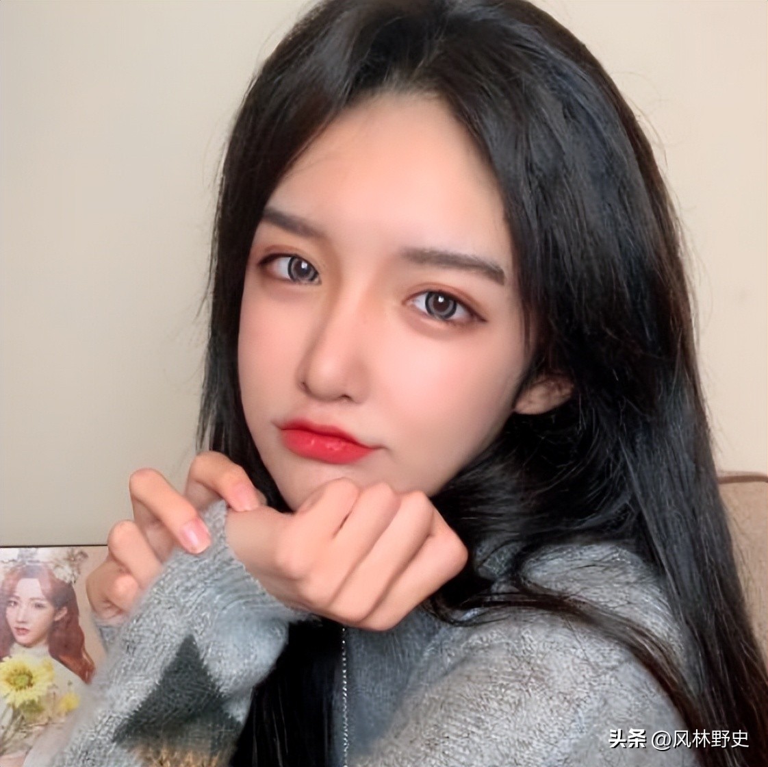 网红变性后遗症,网红变性36天痊愈