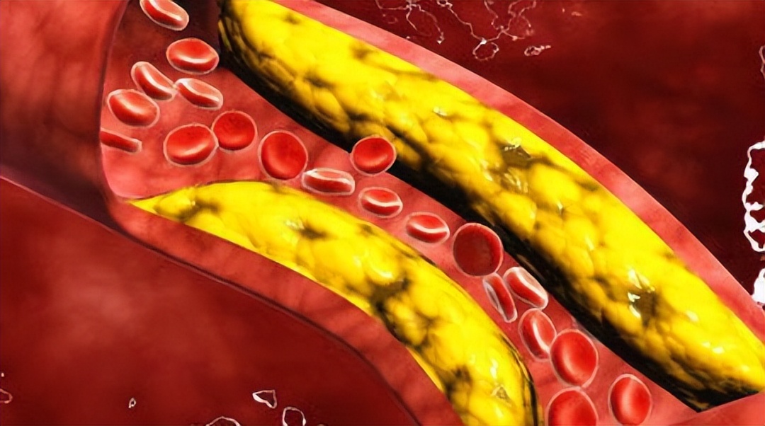 奶茶的危害有多大辟谣,奶茶真的有那么大危害吗