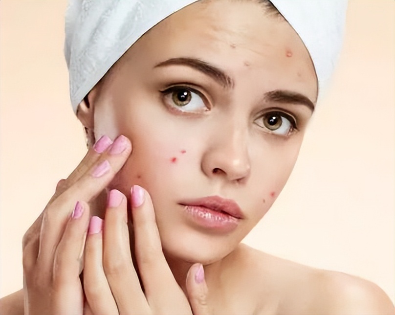 面部痘印中医治疗方案方子,脸上痘印中医的治疗方法